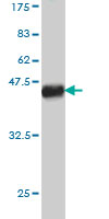 Western blot against tagged recombinant protein immunogen using ab58253 TBX5 antibody at 1ug/ml.