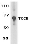 Anti-TCCR antibody (ab5996) at 1 µg/ml + Human spleen tissue lysate