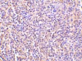 ab5996 at 5µg/ml staining TCCR in human spleen tissue by IHC