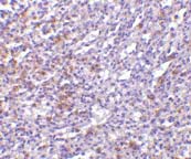 ab5997 at 10µg/ml staining TCCR in human spleen tissue by IHC