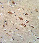 Immunohistochemistry analysis of formalin fixed and paraffin embedded Human brain tissue labelling TCERG1L with ab135726 at 1/50. Antibody was peroxidase conjugated to the secondary antibody, followed by DAB staining.