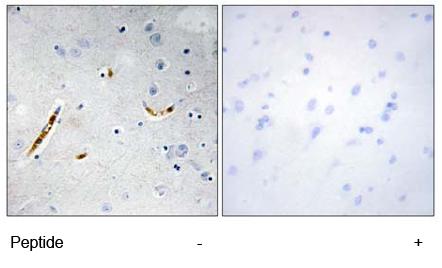ab69999, at a 1/50 dilution, staining human TCF3/E2A in brain, using Immunohistochemistry, Formalin/PFA fixed Paraffin embedded tissue, minus immunising peptide (left image) and plus immunising peptide (right image).