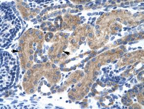 Immunohistochemistry (Formalin/PFA-fixed parraffin-embedded sections) analysis of human kidney tissue labelling Transcription factor 7 with ab30961 at 4-8µg/ml. Positively labelled cells (epithelial cells of renal tubule) are indicated by arrows. Magnification: 400X.