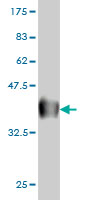 Western blot against tagged recombinant protein immunogen using ab58271 TCF7 antibody at 1ug/ml.