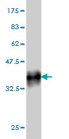Western blot against tagged recombinant protein immunogen using ab56750 TCFL5 antibody at 1ug/ml.