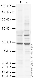 All lanes : Anti-TCHP antibody (ab77622) at 1 µg/mlLane 1 : Tonsil (Human) Whole Cell Lysate - adult normal tissue (ab29615)Lane 2 : U-87 MG (Human glioblastoma astrocytoma) Whole Cell LysateLysates/proteins at 10 µg per lane.SecondaryGoat Anti-Rabbit IgG H&L (HRP) preadsorbed (ab97080) at 1/5000 dilution