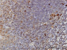 TCP1 alpha antibody (ab57684) used in immunohistochemistry at 3ug/ml on formalin fixed and paraffin embedded human tonsil.