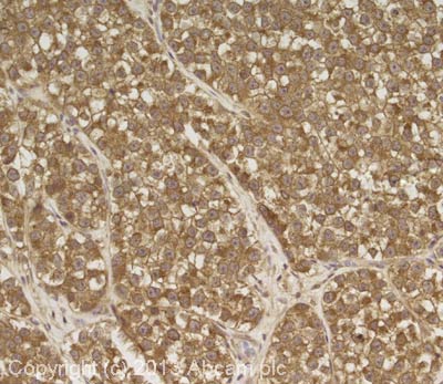 IHC image of TCP1 staining in human testis seminoma formalin fixed paraffin embedded tissue section, performed on a Leica Bond system using the standard protocol F. The section was pre-treated using heat mediated antigen retrieval with sodium citrate buffer (pH6, epitope retrieval solution 1) for 20 mins. The section was then incubated with ab91232, 1µg/ml, for 15 mins at room temperature and detected using an HRP conjugated compact polymer system. DAB was used as the chromogen. The section was then counterstained with haematoxylin and mounted with DPX.For other IHC staining systems (automated and non-automated) customers should optimize variable parameters such as antigen retrieval conditions, primary antibody concentration and antibody incubation times.