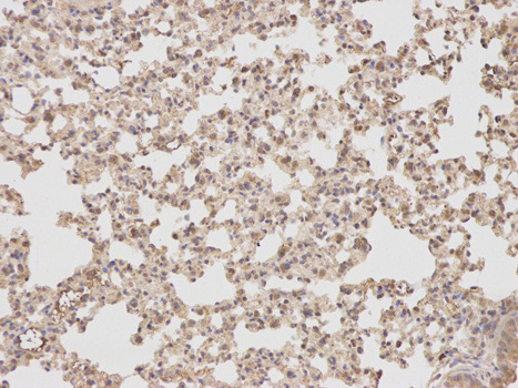 Immunohistochemistry (Formalin/PFA-fixed paraffin-embedded sections) analysis of mouse lung tissue labelling TCPTP with ab180764 at 1/100. Magnification: 200x.