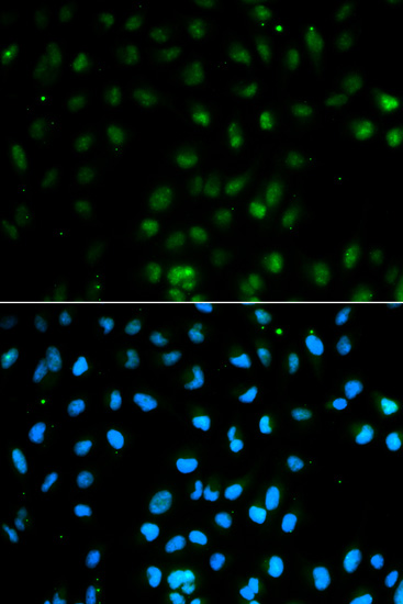 Immunocytochemistry/Immunofluorescence analysis of MCF7 cells using ab180764. Blue DAPI for nuclear staining.