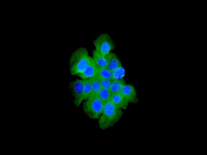 Immunofluorescence analysis of A431 cells staining TCTP (green) using ab133568 at a 1/250 dilution. Cell nuclei are shown in blue.
