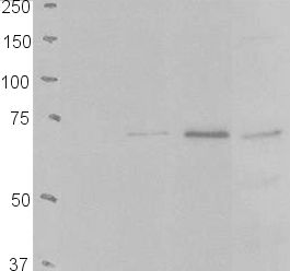 Lane 1 :  Molecular weight markersLanes 2 - 5 :  Anti-TDP1 antibody (ab4166) at 1/1000 dilutionLane 1 : As aboveLane 2 : 1 ng purified recombinant human TDP1Lane 3 : 3 ng purified recombinant human TDP1Lane 4 : 6 ng purified recombinant human TDP1Lane 5 : 6 micrograms total protein from MCF7 human cell extract developed using the ECL techniquePerformed under reducing conditions.