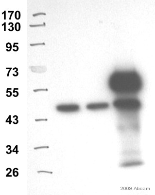Lane 1: Marker, Lane 2: 293T Total Lysate (Input), Lane 3: 293T supernatant (Flow through), LAne 4: Pull down (IP).See Abreview