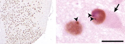 ab41881 staining TARDBP in murine spinal cord by Immunohistochemistry (PFA perfusion fixed frozen sections).Tissues fixed by 4% paraformaldehyde in phosphate buffer (pH 7.4) were cryoprotected by 30% sucrose in PBS (pH 7.4). Frozen sections (10 µm) of spinal cord tissues from three or more transgenic mice, respectively, were processed for immunofluorescence using ab41881. An Alexa Fluor 594 was used as secondary antibodies to visualize protein. Scale bar 20 µm.TARDBP is localized in the nucleus and forms intranuclear granular structures, arrowheads.