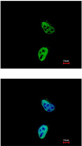 Immunofluorescence analysis of paraformaldehyde-fixed HeLa, labeling TARDBP with ab154047 at 1/200 dilution. Lower image is merged with DNA probe.