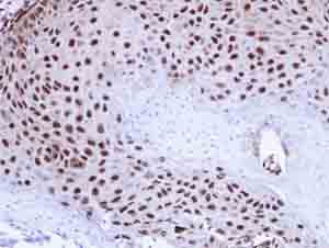 Immunohistochemical analysis of paraffin-embedded Human Cal27 Xenograft tissue, labeling TARDBP with ab154047 at 1/100 dilution.