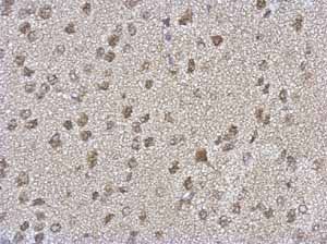 Immunohistochemical analysis of paraffin-embedded Rat brain tissue, labeling TARDBP with ab154047 at 1/500 dilution.