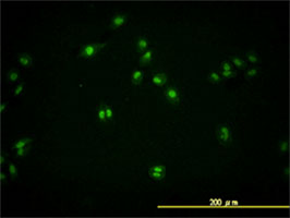 TARDBP antibody (ab57105) used in immunofluorescence at 10ug/ml on HeLa cells.