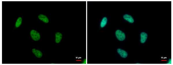 Immunofluorescent analysis of HeLa cells fixed in 4% paraformaldehyde at RT for 15 min labeling TARDBP using ab184645 diluted 1/500 (green). Hoechst 33342 staining (blue).