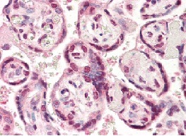ab115952 at 10 ug/ml staining TARDBP in formalin fixed Human placenta tissue by immunohistochemistry. Also stained with biotinylated anti-mouse IgG secondary antibody, alkaline phosphatase-streptavidin and chromogen.