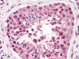 ab115952 at 10 ug/ml staining TARDBP in formalin fixed Human testis tissue by immunohistochemistry. Also stained with biotinylated anti-mouse IgG secondary antibody, alkaline phosphatase-streptavidin and chromogen.