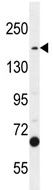 Anti-TDRD7 antibody (ab107675) at 1/100 dilution + A549 cell lysate at 35 µg