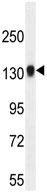 Anti-TDRD7 antibody (ab107675) at 1/100 dilution + Mouse bladder tissue lysate at 35 µg