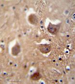 ab107675, at 1/50 dilution, staining TDRD7 in formalin-fixed, paraffin-embedded Human brain tissue by Immunohistochemistry using a peroxidase conjugated secondary antibody and DAB staining.