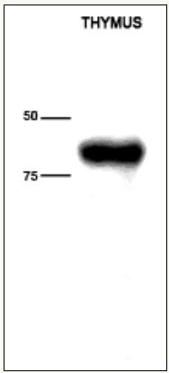 Anti-TdT antibody [41C] (ab68886) at 1/100 dilution + Thymus extracts