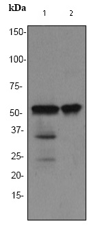 All lanes : Anti-TdT antibody [EPR2976Y] (ab76544) at 1/10000 dilutionLane 1 : Human thymus lysateLane 2 : Jurkat lysateLysates/proteins at 10 µg per lane.SecondaryHRP labelled goat anti-rabbit at 1/2000 dilution
