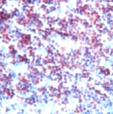 ab15243 staining TdT in human thymus tissue section by Immunohistochemistry (Formalin/ PFA fixed paraffin-embedded tissue sections).