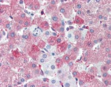 ab115554, at 5µg/ml, staining SIL1 in Formalin-fixed, Paraffin-embedded Human Liver tissue by Immunohistochemistry followed by biotinylated secondary antibody, alkaline phosphatase-streptavidin and chromogen.