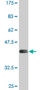 Anti-SLC26A2 antibody (ab77464) at 5 µg/ml + immunogen at 0.2 µgSecondaryGoat anti-mouse IgG (H&L)-HRP conjugate