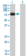 All lanes : Anti-TEM7 antibody (ab68354) at 1/500 dilutionLane 1 : TEM7 transfected 293T cell lysateLane 2 : Non-transfected 293T cell lysateLysates/proteins at 25 µg per lane.SecondaryGoat Anti-Mouse IgG (H&L)-HRP Conjugate at 1/2500 dilution