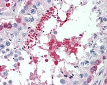 ab115554, at 5µg/ml, staining SIL1 in Formalin-fixed, Paraffin-embedded Human Testis tissue by Immunohistochemistry followed by biotinylated secondary antibody, alkaline phosphatase-streptavidin and chromogen.