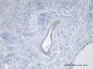 ab13667 at a 1/1500 dilution staining human brain tumor (glioblatoma) samples by Immunohistochemistry (Formalin-fixed paraffin-embedded sections). Heat mediated antigen retrieval was used and the tissue was fixed with ethanol and blocked with 2.5% serum prior to incubation with the antibody for 16 hours. A pan-specifc universal secondary antibody was used.See Abreview