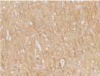 ab21270 at 2µg/ml staining TEM8 in human brain tissue by IHC