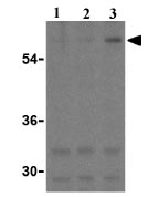 Lane 1 :  Anti-TEM8 antibody (ab21269) at 0.5 µg/mlLane 2 :  Anti-TEM8 antibody (ab21269) at 1 µg/mlLane 3 :  Anti-TEM8 antibody (ab21269) at 2 µg/mlLane 1 : K562 cell lysateLane 2 : K562 cell lysateLane 3 : K562 cell lysate