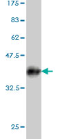Western blot against tagged recombinant protein immunogen using ab54836 SLC26A3 antibody at 1ug/ml. 