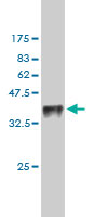 Western blot against tagged recombinant protein immunogen using ab58294 TESK1 antibody at 1ug/ml.