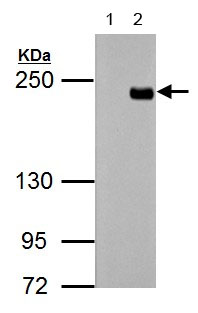 All lanes : Anti-TET3 antibody - C-terminal (ab153724) at 1/5000 dilutionLane 1 : 293T whole cell lysateLane 2 : Human TET3-transfected 293T whole cell lysate with DDDDK tag Lysates/proteins at 30 µg per lane.