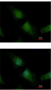 Immunofluorescent analysis of paraformaldehyde-fixed HeLa cells, labeling TET3 with ab153724 at 1/500 dilution. Lower image shows cells co-stained with Hoechst 33342.
