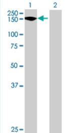 All lanes : Anti-TEX2 antibody (ab69071) at 1/500 dilutionLane 1 : TEX2 transfected 293T cell lysateLane 2 : Non-transfected 293T cell lysateLysates/proteins at 25 µg per lane.SecondaryGoat anti-mouse IgG (H&L)-HRP conjugate at 1/2500 dilution