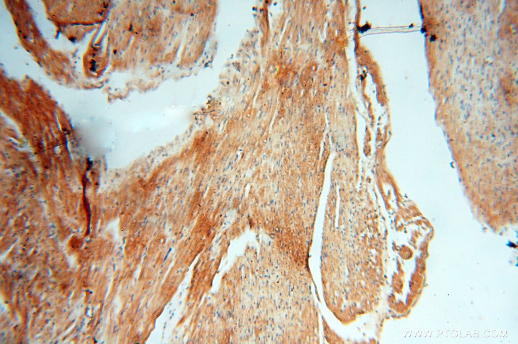 Immunohistochemistry of paraffin-embedded H-heart using 14498-1-AP(CEP250,C-NAP1 Antibody) at Dilution 1:50 (under 10x lens)