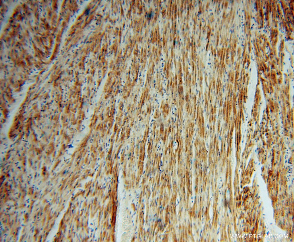 Immunohistochemical of  paraffin-embedded human heart using 16006-1-AP(mitoNEET,CISD1 antibody) at dilution of 1:100 (under 10x lens)