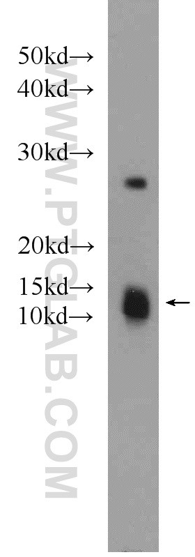 HEK-293 cells were subjected to SDS PAGE followed by western blot with 24209-1-AP(C1orf31 antibody) at dilution of 1:1000