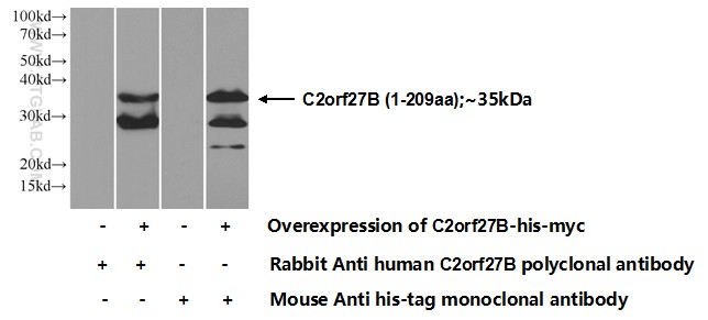 Transfected HEK-293 cells were subjected to SDS PAGE followed by western blot with 24348-1-AP( C2orf27B Antibody) at dilution of 1:500