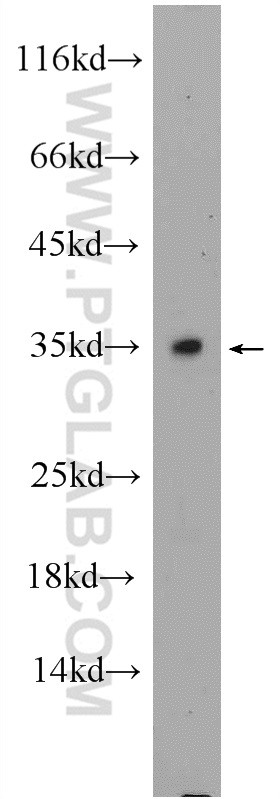 Mouse testis tissue were subjected to SDS PAGE followed by western blot with 25464-1-AP( C2orf51 Antibody) at dilution of 1:300