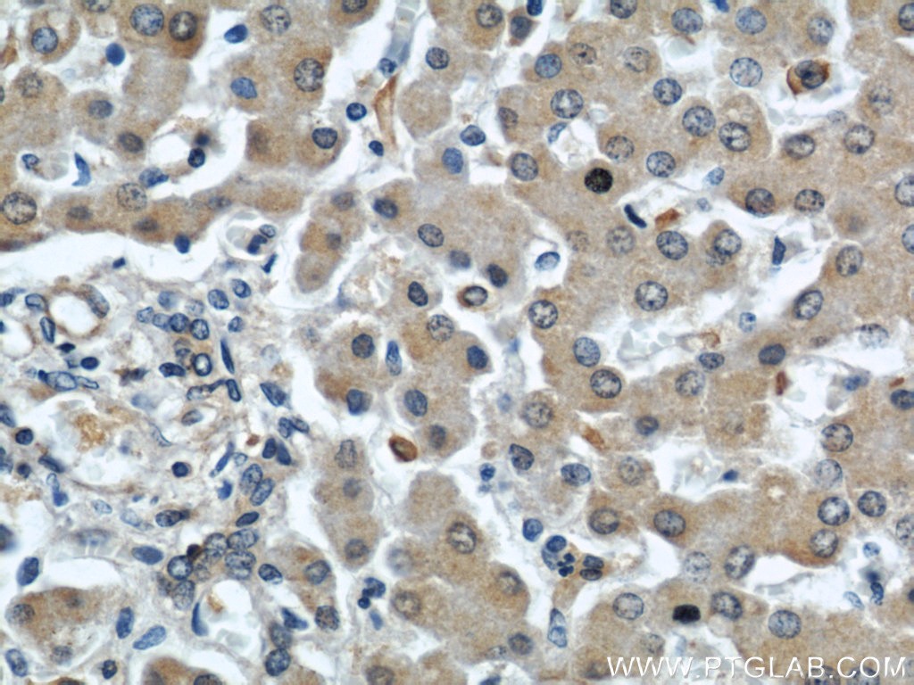 Immunohistochemical of  paraffin-embedded human liver using 22838-1-AP(C7orf30 antibody) at dilution of 1:50 (under 40x lens)