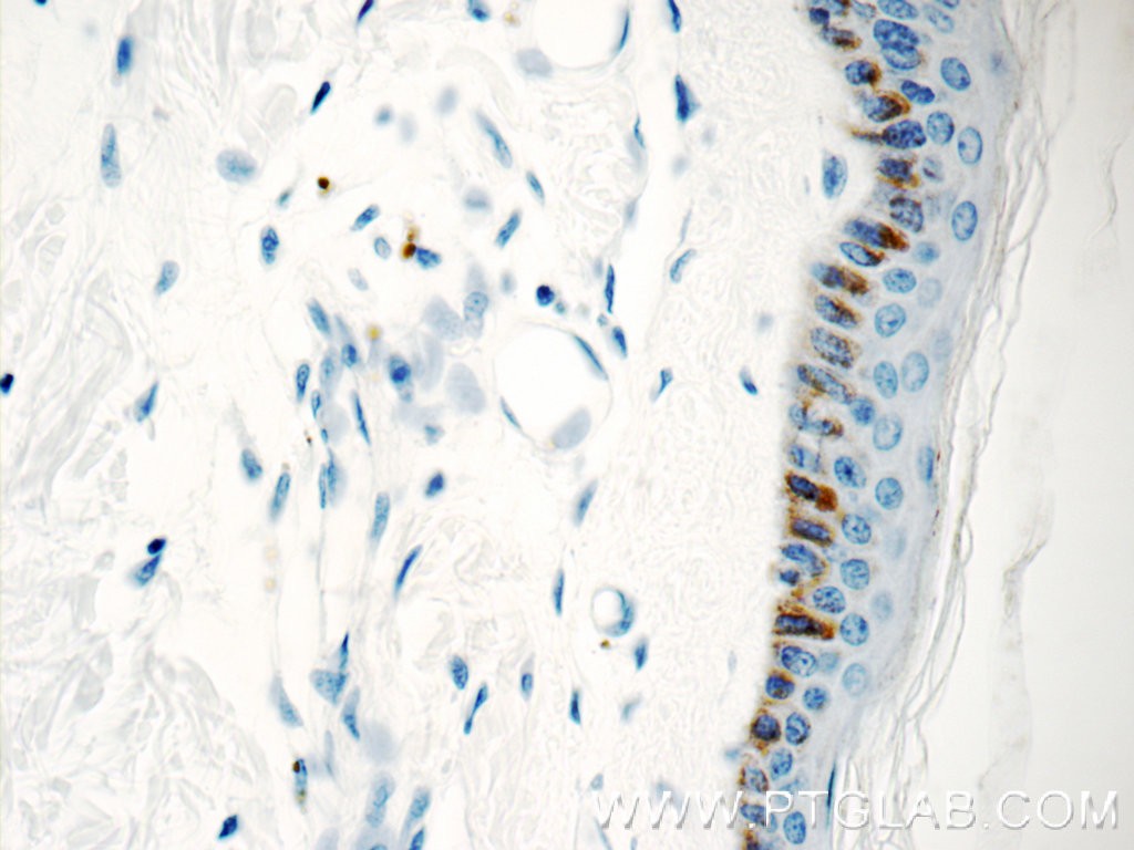 Immunohistochemistry of paraffin-embedded human skin tissue slide using 15076-1-AP( C7orf49 Antibody) at dilution of 1:50 (under 40x lens)